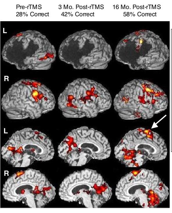 Fmri Language