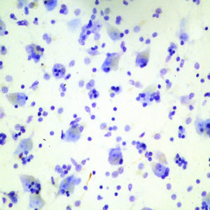 Microscopic section from 65 year old control subject showing no tau protein deposition.