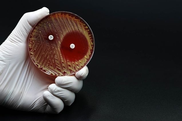 Hand of scientist or doctor showing a microbiological culture Petri dish with bacteria where an antibiotic resistance test has been carried out.