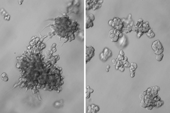 Human Mammory tumor before and after AhR treatment Human Mammory tumor before and after AhR treatment