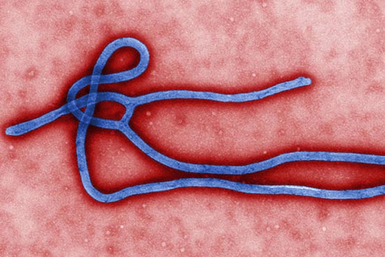 Boston University BU, ebola virus, point of view POV, opinon editorial op ed, Peter Duprex