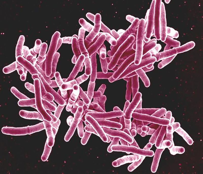 Microscopic image of tuberculosis bacteria