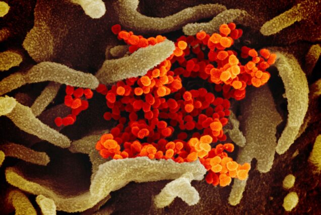 Image from The National Institute of Allergy and Infectious Diseases (NIAID), of an electron microscope image showing SARS-CoV-2 (orange)—also known as 2019-nCoV, the virus that causes COVID-19—isolated from a patient in the U.S., emerging from the surface of cells (green) cultured in the lab.