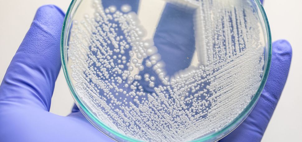 photo of a blue-gloved hand holding a clear petri dish of yeasts. The white yeast lie in criss-crossed pattern and the hand adds a contrast to make it clearer to see them.