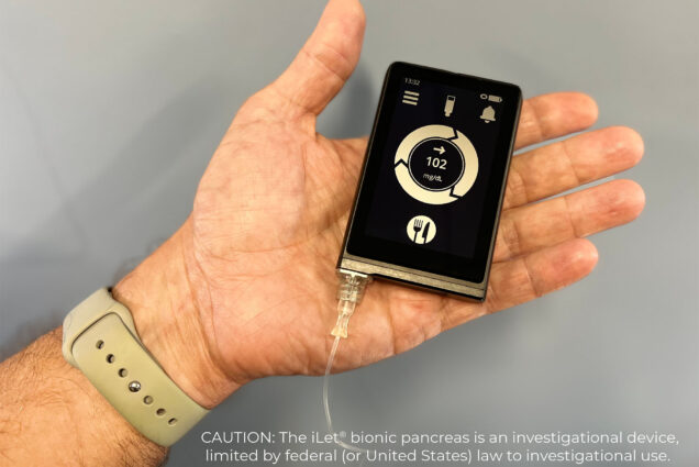 Image: Photo of The iLet bionic pancreas, which automatically monitors blood glucose levels and delivers tailored insulin doses. A hand displays a small black device with gold details and display with gold buttons. Display shows the blood glucose reading and has a symbol of food on it. Text on image reads "CAUTION: The iLet bionic pancreas is an investigational device, limited by federal (or United states) law to investigational use."