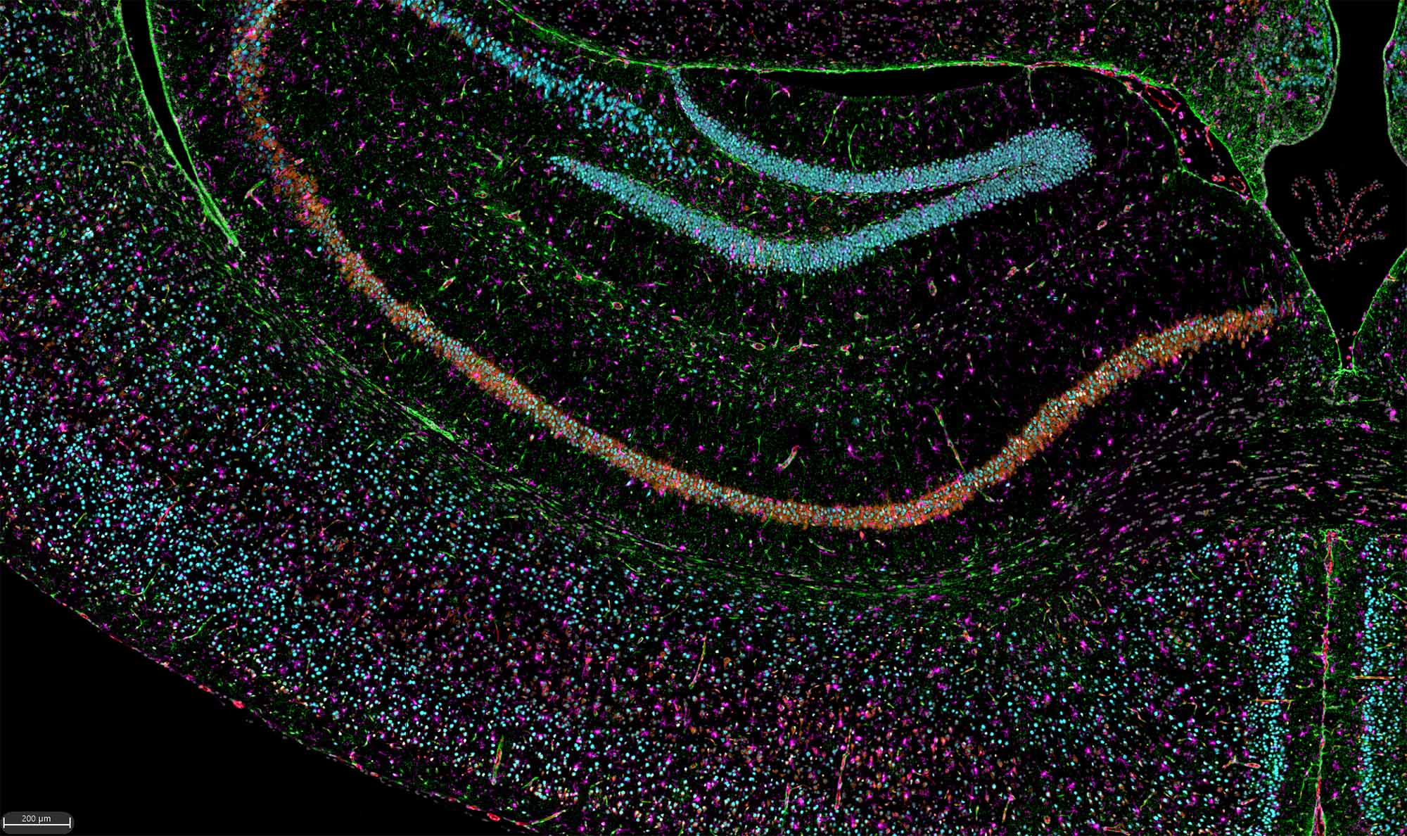 Image: Transgenic mouse model expressing the hACE2 protein. A black background with orange, green, teal, magenta, red, and grey dots in varying patterns.