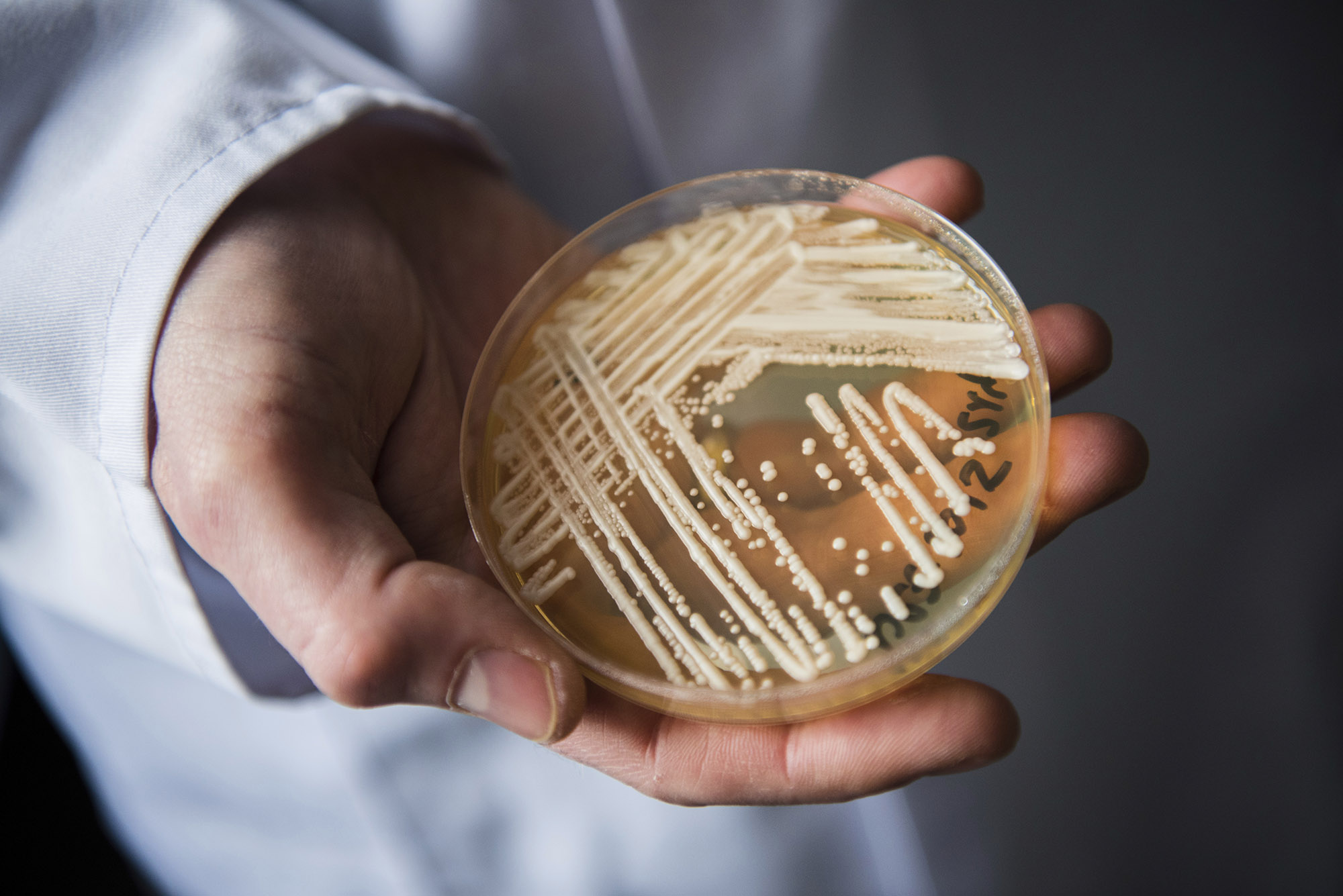 A New Drug-Resistant Fungus Is Spreading in Hospitals image