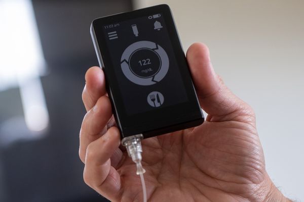 Image: Photo of The iLet bionic pancreas, which automatically monitors blood glucose levels and delivers tailored insulin doses. A hand displays a small black device with gold details and display with gold buttons. Display shows the blood glucose reading and has a symbol of food on it. Text on image reads "CAUTION: The iLet bionic pancreas is an investigational device, limited by federal (or United states) law to investigational use."