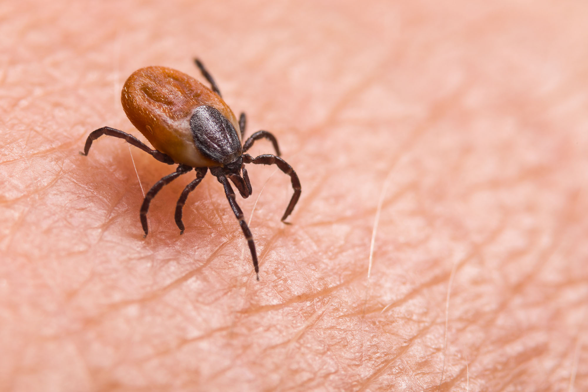 Photo: A stock photo of a deer tick zoomed in on skin.