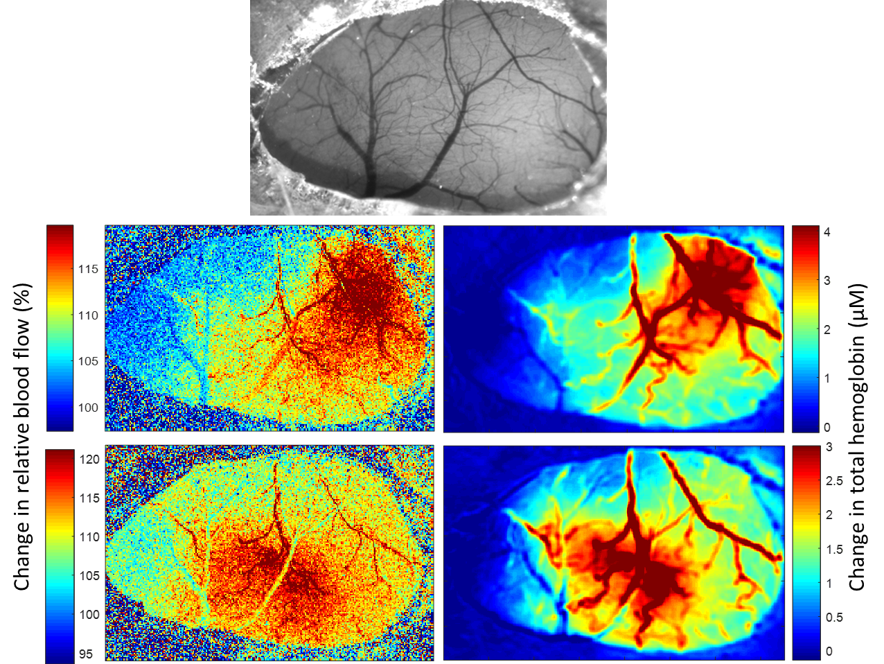 Simultaneous Multispectral and Laser Speckle Imaging | Neurophotonics Center