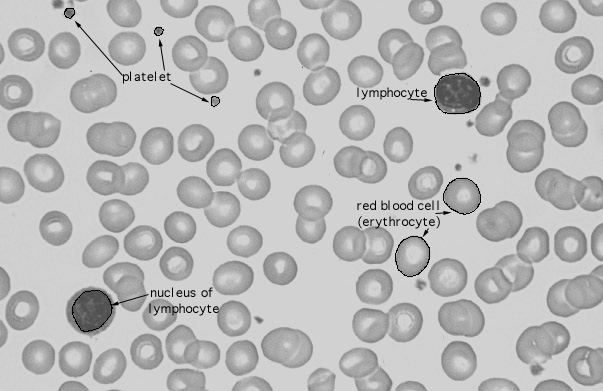 white blood cell labeled