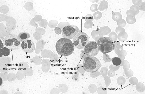  bone marrow smear, granulocyte series 