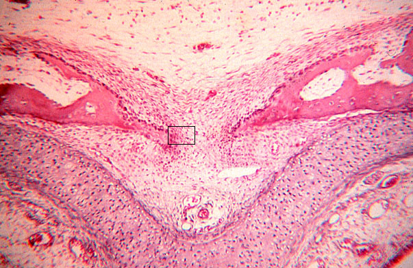  hyaline cartilage, intramembranous bone formation 