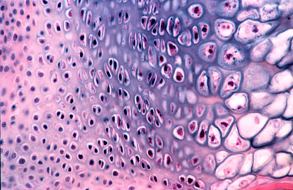 HLS [ Cartilage and Bone and Bone Histogenesis, endochondral ...