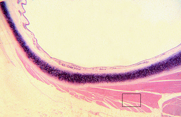  skeletal muscle, banding patterns 