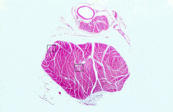  skeletal muscle, connective tissue investments, transverse 