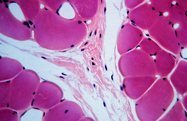  skeletal muscle, ensheathment, transverse 