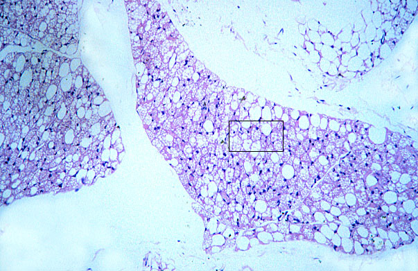  multilocular (brown) adipocytes 