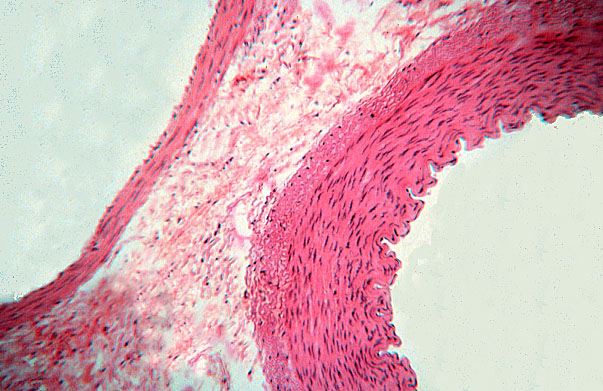  muscular arteries and medium veins, femoral 