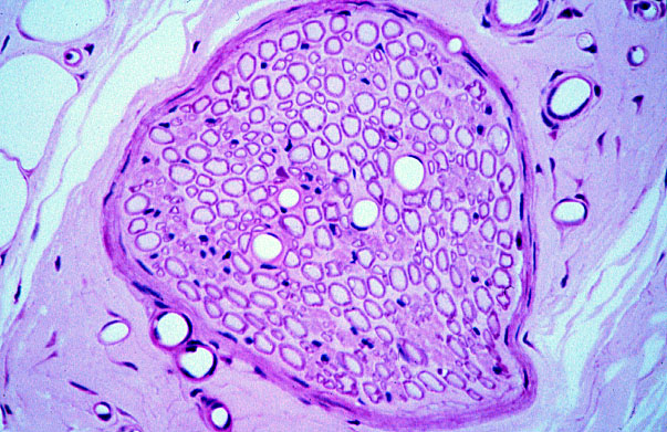  peripheral nerve, transverse 