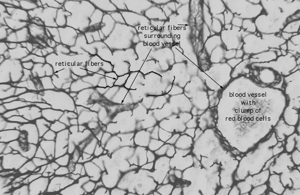 reticular fibers labeled