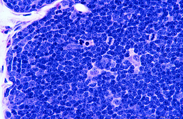  thymus, epithelio reticular cells 