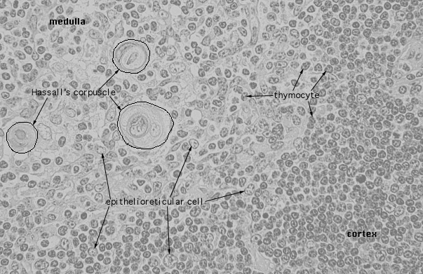  involuted thymus 