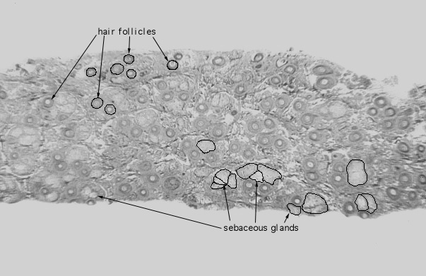  scalp, transverse 