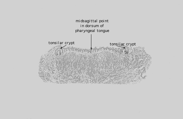  lingual tonsil 