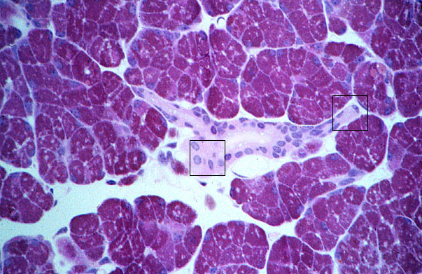  parotid gland, striated and intercalated ducts 