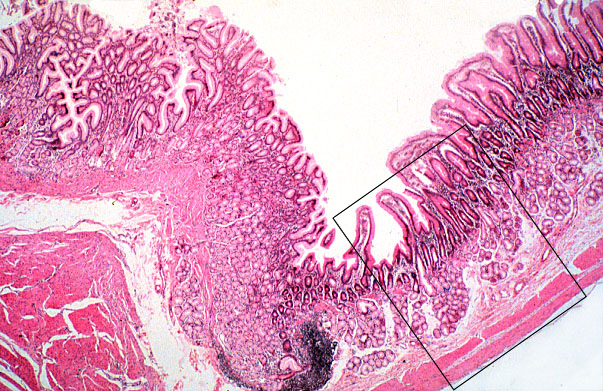  pyloro/duodenal junction, mucosa 