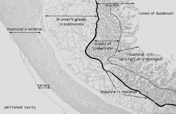  pyloro/duodenal junction 