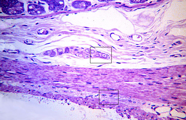  parasympathetic plexuses 