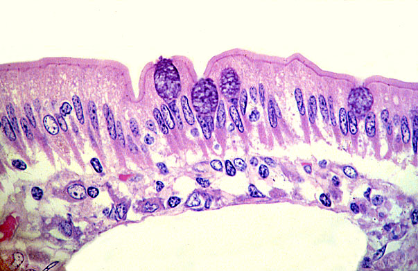  jejunum, goblet cells and enterocytes 