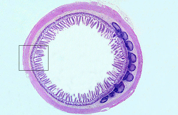  ileum 