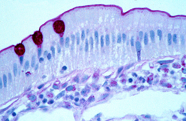 Hls Digestive System Alimentary Canal Jejunum Glycocalyx And Enteroendocrine Cell High Mag