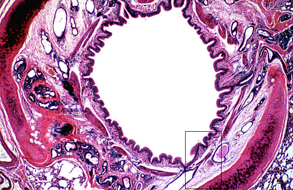  lung (sheep), intrapulmonary bronchus 