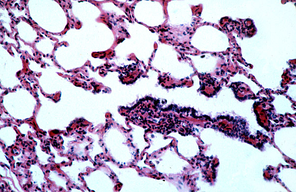  lung (sheep), respiratory bronchiole 