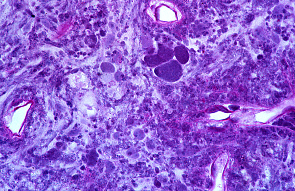  pituitary gland, posterior 