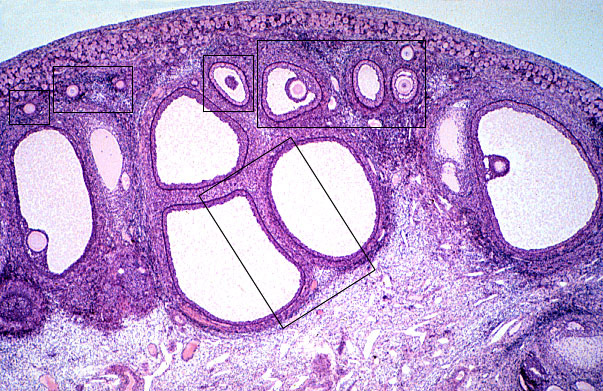  ovary, cortex 