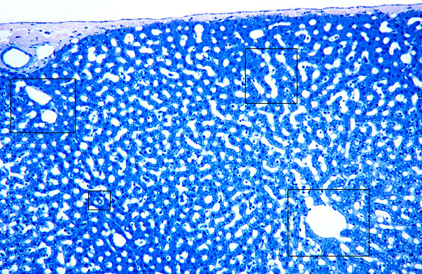  liver, classic lobule 