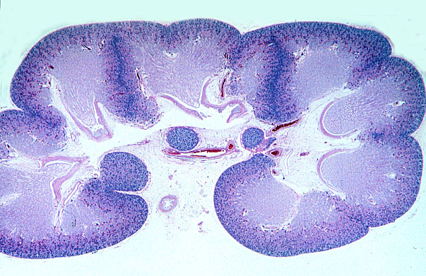  neonatal kidney 
