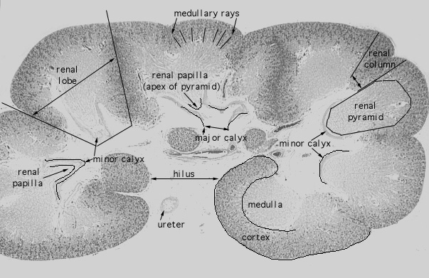  neonatal kidney 