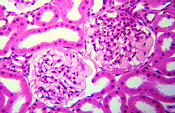  kidney, H&E, vascular/urinary poles 