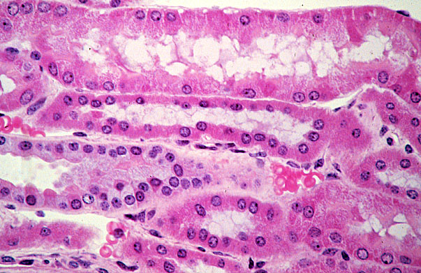  kidney, H&E, medulla 