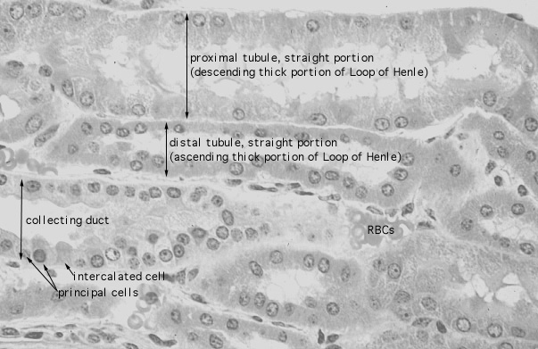  kidney, H&E, medulla 