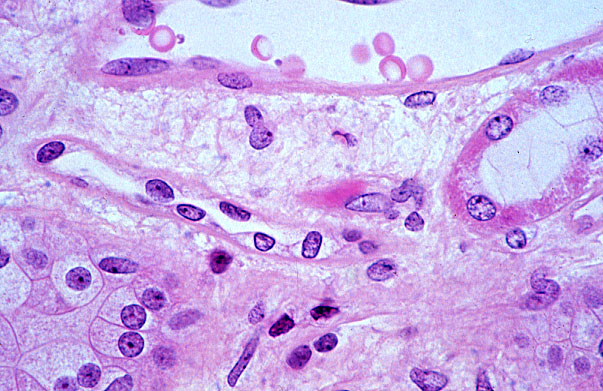  kidney, H&E, thin loop of Henle and vasa recta 