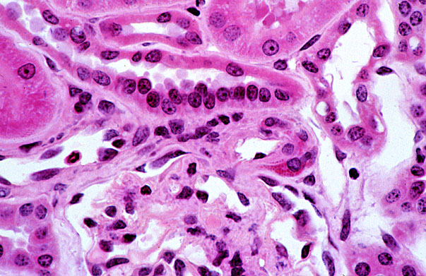  kidney, H&E, macula densa 