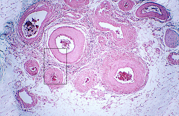 pampiniform plexus histology