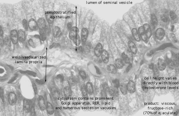 seminal vesicle histology labeled